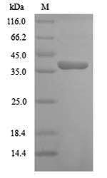 Cyclin-dependent kinase B1-2 (CDKB1-2), Arabidopsis thaliana, recombinant