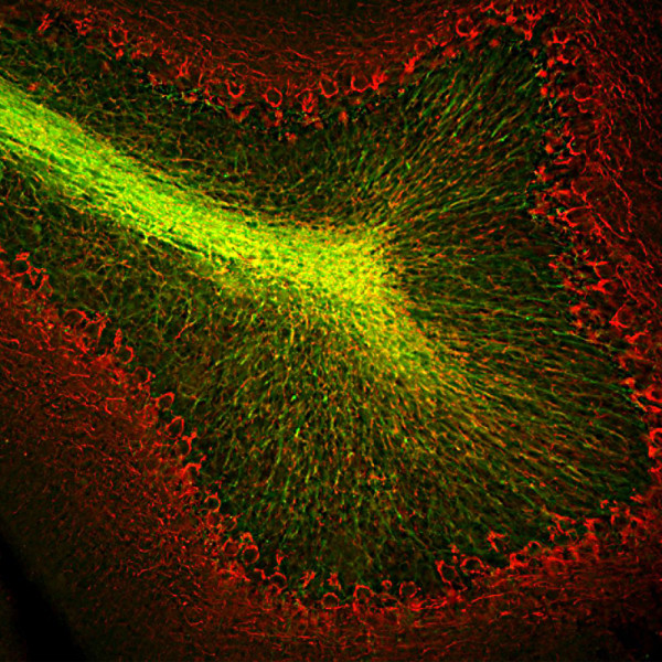 Anti-CNPase, clone 1H10