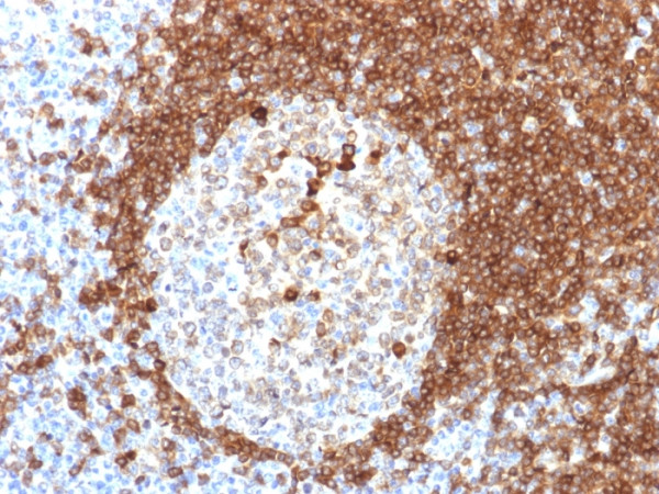 Anti-CD79a (B-Cell Marker), clone HM57