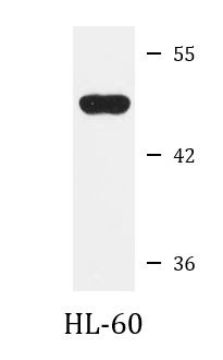 Anti-RPL4
