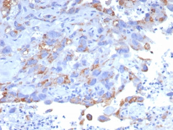 Anti-GPRC5A / Retinoic acid-induced protein 3 / PEIG-1, clone GPRC5A/7893