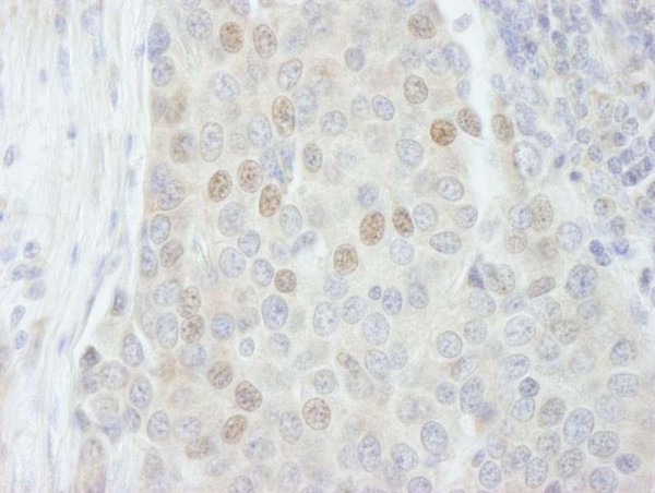 Anti-RBM27 (IHC)