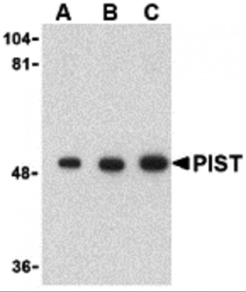 Anti-GOPC / PIST