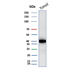 Anti-Clusterin / Apolipoprotein J, clone r7D1