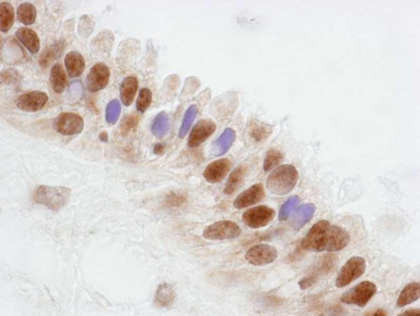 Anti-CoAA (IHC)