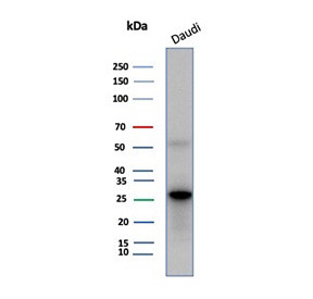 Anti-CD200R1 / CD200 receptor 1, clone CD200R1/6493