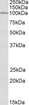 Anti-CLCN2, Internal