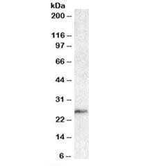 Anti-BCL7A