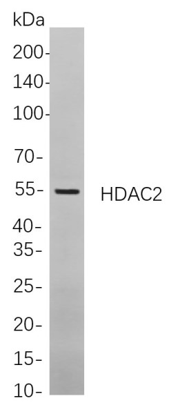 Anti-Recombinant HDAC2, clone 2C5