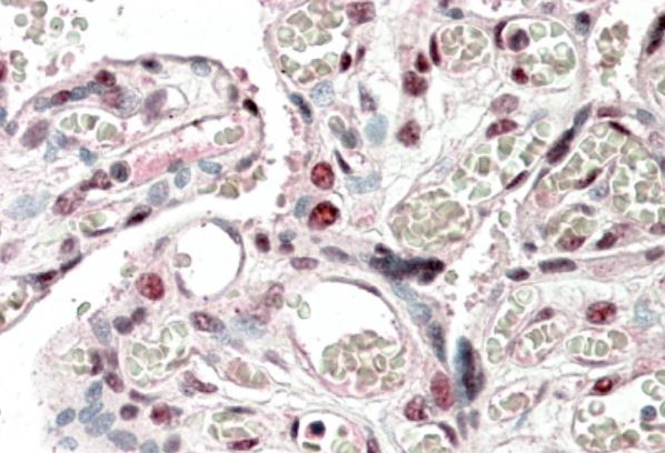 Anti-CREB3L2 / BBF2H7