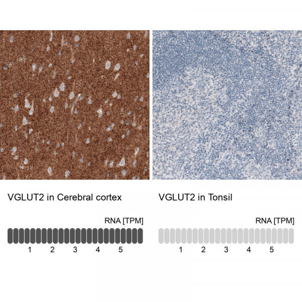 Anti-VGLUT2, clone CL2921