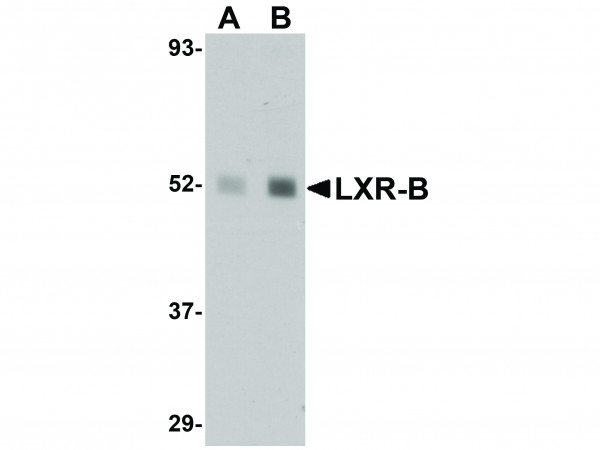 Anti-LXR-B