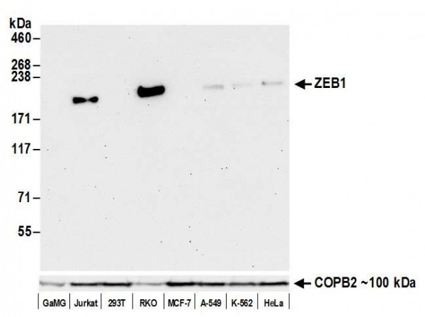 Anti-ZEB1 Recombinant Monoclonal