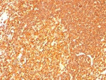 Anti-HLA-DRB1 Cocktail (MHC II), clone LN3 + HLA-DRB/1067