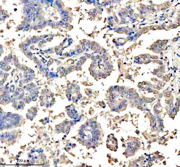 Anti-ASCL1 / Achaete-scute homolog 1