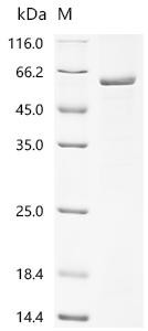 Inactive hydroxysteroid dehydrogenase-like protein 1 (HSDL1), recombinant human