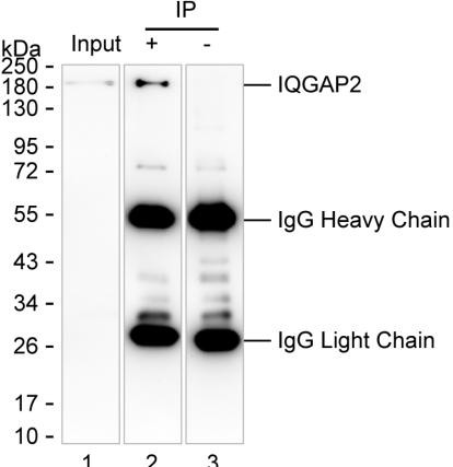 Anti-IQGAP2