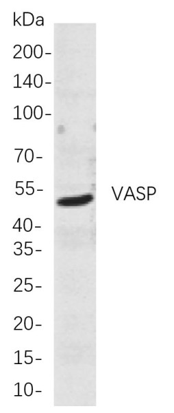 Anti-Recombinant VASP, clone 11A10