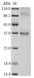 Probable G-protein coupled receptor 146 (Gpr146), mouse, recombinant