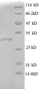 50S ribosomal protein L30 (rpmD), Escherichia coli, recombinant
