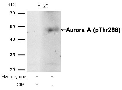 Anti-phospho-Aurora A (Thr288)