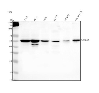 Anti-SCARA5 / Scavenger receptor class A member 5