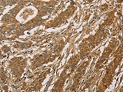 Anti-CYP39A1