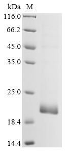Membrane protein (M), partial, human coronavirus 229E, recombinant