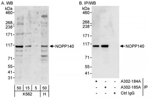 Anti-NOPP140