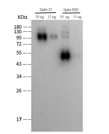 Anti-SARS-CoV/SARS-CoV-2 Spike RBD (2019-nCoV)