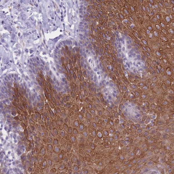 Anti-DCANP1