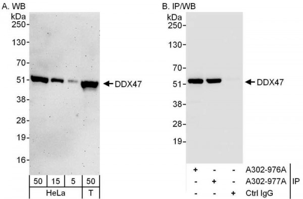 Anti-DDX47