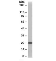 Anti-TMS1