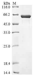 Lactase-like protein (LCTL), partial, human, recombinant