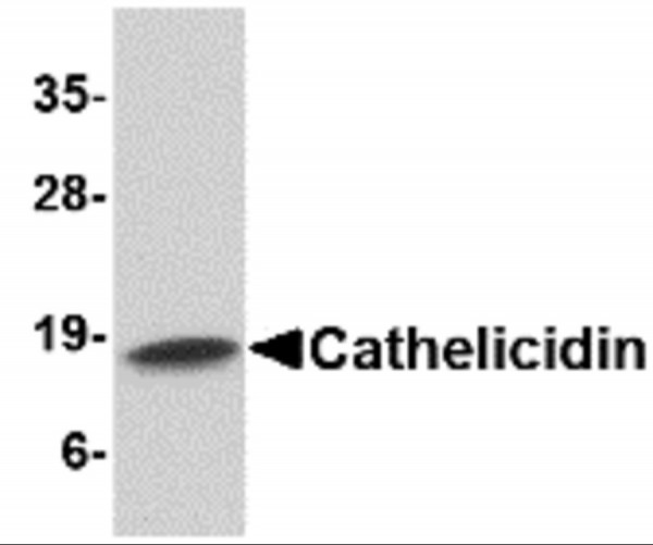 Anti-Cathelicidin