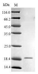 High affinity immunoglobulin epsilon receptor subunit gamma (FCER1G), partial, human, recombinant