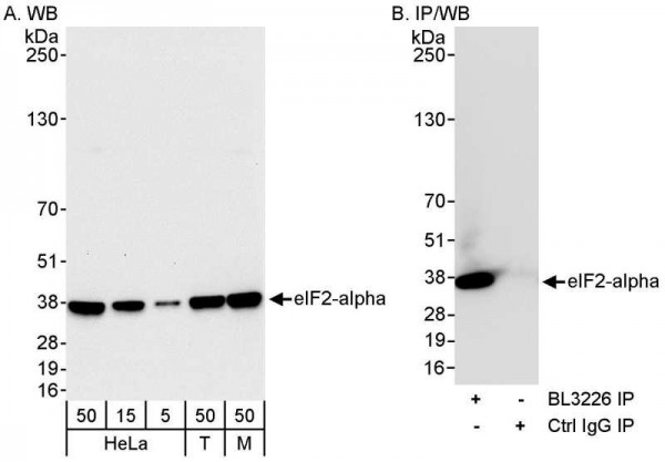 Anti-eIF2alpha/EIF2S1