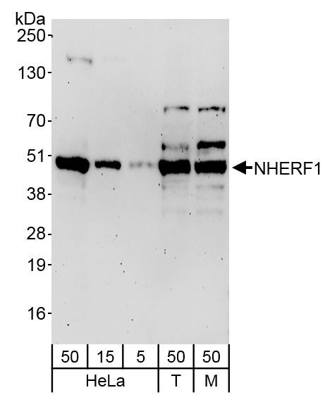Anti-NHERF1