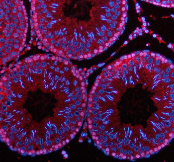 Anti-PDZD8 / PDZ domain-containing protein 8
