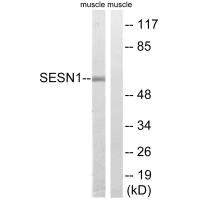 Anti-SESN1