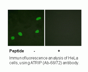 Anti-ATRIP (Ab-68/72)