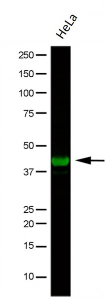 Anti-gamma Actin, clone 2A3