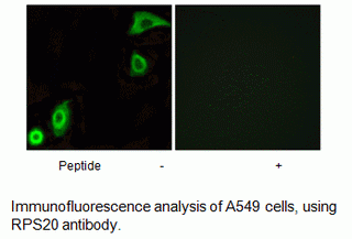 Anti-RPS20
