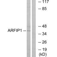 Anti-ARFIP1