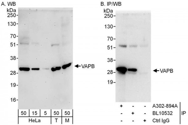 Anti-VAPB