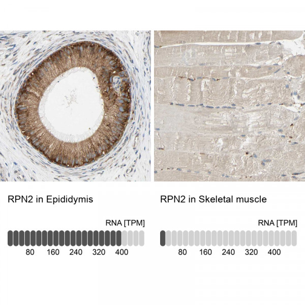 Anti-RPN2