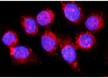 Anti-EHD1 / EH domain-containing protein 1 / PAST1