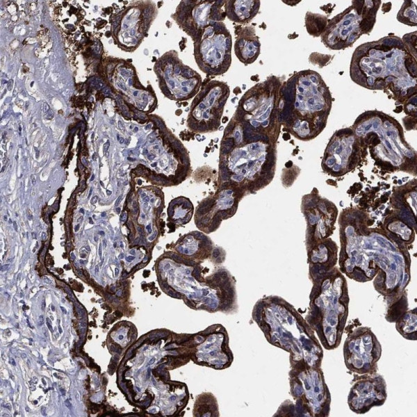 Anti-SERPINB2