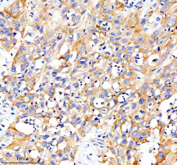 Anti-CARD10 / Caspase recruitment domain-containing protein 10