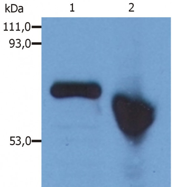 Anti-alpha 1 Fetoprotein, clone AFP-01